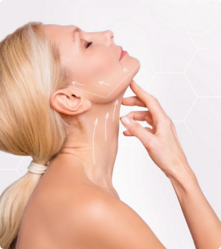 Lifting cervico-facial